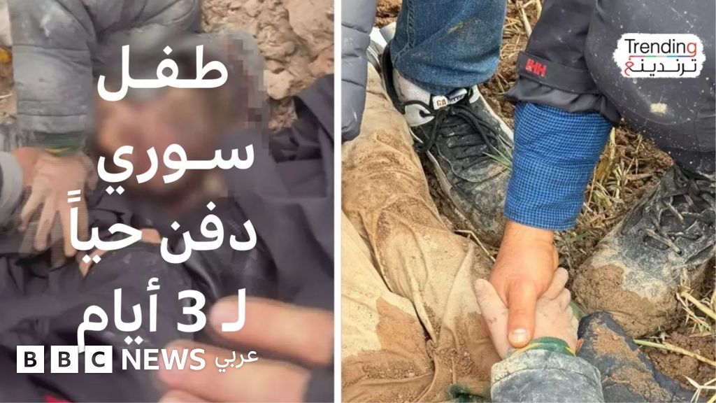 إنقاذ طفل سوري مفقود بعد العثور عليه مدفون حيا في تركيا